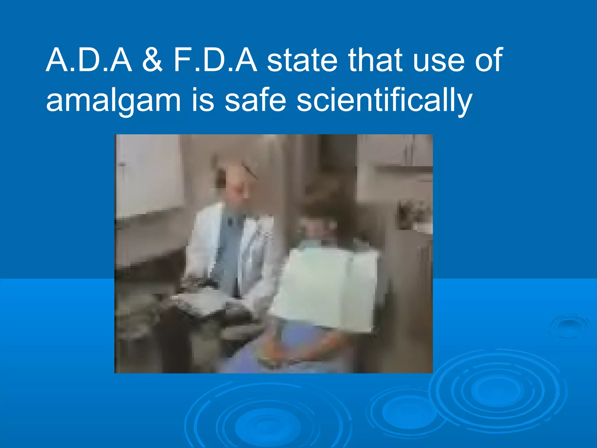 A.D.A & F.D.A state that use of 
amalgam is safe scientifically 
 