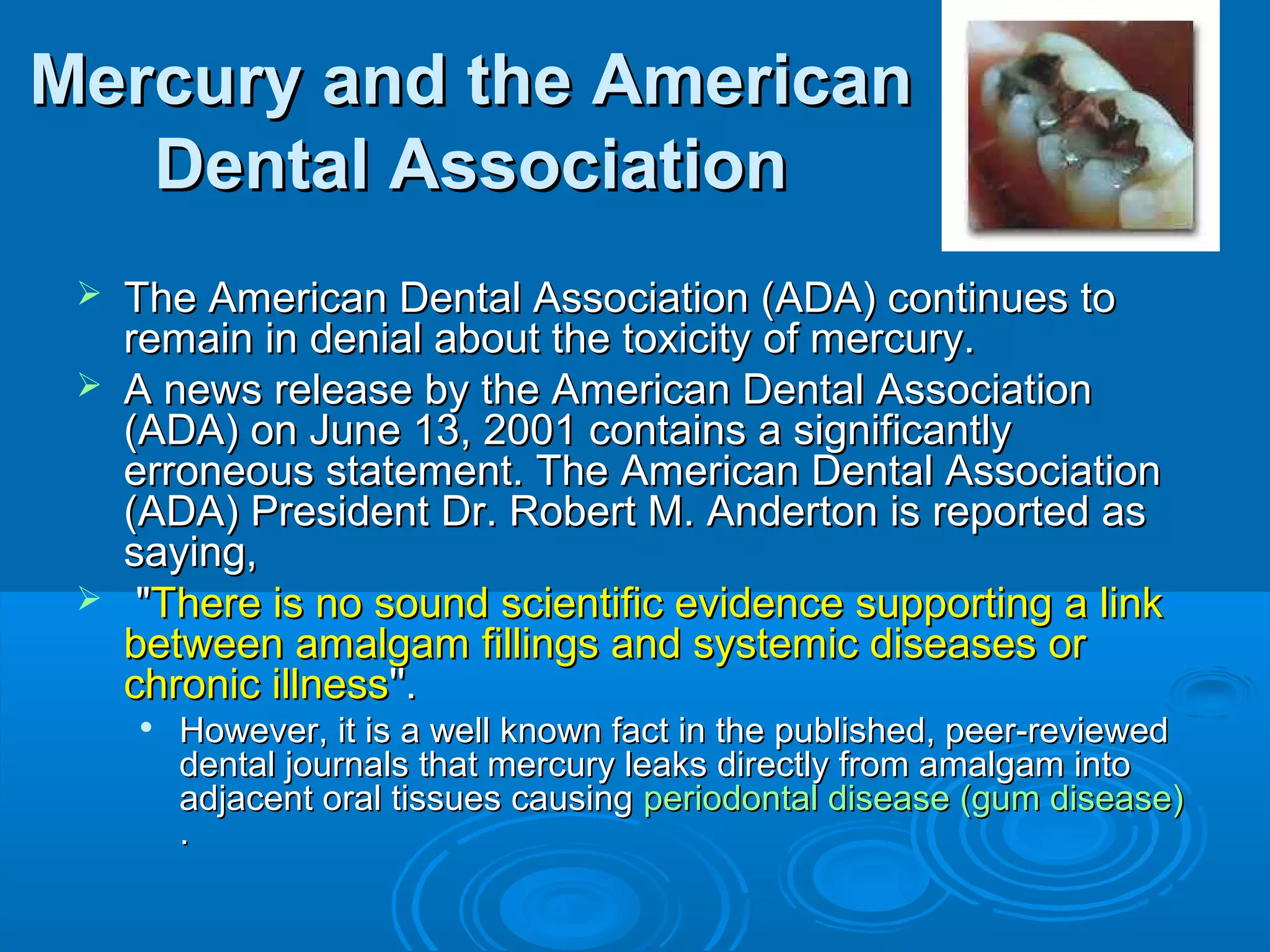 Mercury aanndd tthhee AAmmeerriiccaann 
DDeennttaall AAssssoocciiaattiioonn 
 TThhee AAmmeerriiccaann DDeennttaall AAssssoocciiaattiioonn ((AADDAA)) ccoonnttiinnuueess ttoo 
rreemmaaiinn iinn ddeenniiaall aabboouutt tthhee ttooxxiicciittyy ooff mmeerrccuurryy.. 
 AA nneewwss rreelleeaassee bbyy tthhee AAmmeerriiccaann DDeennttaall AAssssoocciiaattiioonn 
((AADDAA)) oonn JJuunnee 1133,, 22000011 ccoonnttaaiinnss aa ssiiggnniiffiiccaannttllyy 
eerrrroonneeoouuss ssttaatteemmeenntt.. TThhee AAmmeerriiccaann DDeennttaall AAssssoocciiaattiioonn 
((AADDAA)) PPrreessiiddeenntt DDrr.. RRoobbeerrtt MM.. AAnnddeerrttoonn iiss rreeppoorrtteedd aass 
ssaayyiinngg,, 
 ""TThheerree iiss nnoo ssoouunndd sscciieennttiiffiicc eevviiddeennccee ssuuppppoorrttiinngg aa lliinnkk 
bbeettwweeeenn aammaallggaamm ffiilllliinnggss aanndd ssyysstteemmiicc ddiisseeaasseess oorr 
cchhrroonniicc iillllnneessss''''.. 
 HHoowweevveerr,, iitt iiss aa wweellll kknnoowwnn ffaacctt iinn tthhee ppuubblliisshheedd,, ppeeeerr--rreevviieewweedd 
ddeennttaall jjoouurrnnaallss tthhaatt mmeerrccuurryy lleeaakkss ddiirreeccttllyy ffrroomm aammaallggaamm iinnttoo 
aaddjjaacceenntt oorraall ttiissssuueess ccaauussiinngg ppeerriiooddoonnttaall ddiisseeaassee ((gguumm ddiisseeaassee)) 
.. 
 