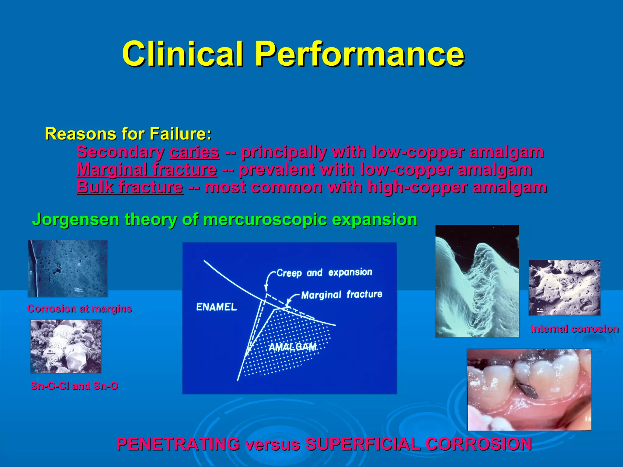 CClliinniiccaall PPeerrffoorrmmaannccee 
RReeaassoonnss ffoorr FFaaiilluurree:: 
SSeeccoonnddaarryy ccaarriieess ---- pprriinncciippaallllyy wwiitthh llooww--ccooppppeerr aammaallggaamm 
MMaarrggiinnaall ffrraaccttuurree ---- pprreevvaalleenntt wwiitthh llooww--ccooppppeerr aammaallggaamm 
BBuullkk ffrraaccttuurree ---- mmoosstt ccoommmmoonn wwiitthh hhiigghh--ccooppppeerr aammaallggaamm 
JJoorrggeennsseenn tthheeoorryy ooff mmeerrccuurroossccooppiicc eexxppaannssiioonn 
CCoorrrroossiioonn aatt mmaarrggiinnss 
SSnn--OO--CCll aanndd SSnn--OO 
IInntteerrnnaall ccoorrrroossiioonn 
PPEENNEETTRRAATTIINNGG vveerrssuuss SSUUPPEERRFFIICCIIAALL CCOORRRROOSSIIOONN 
 