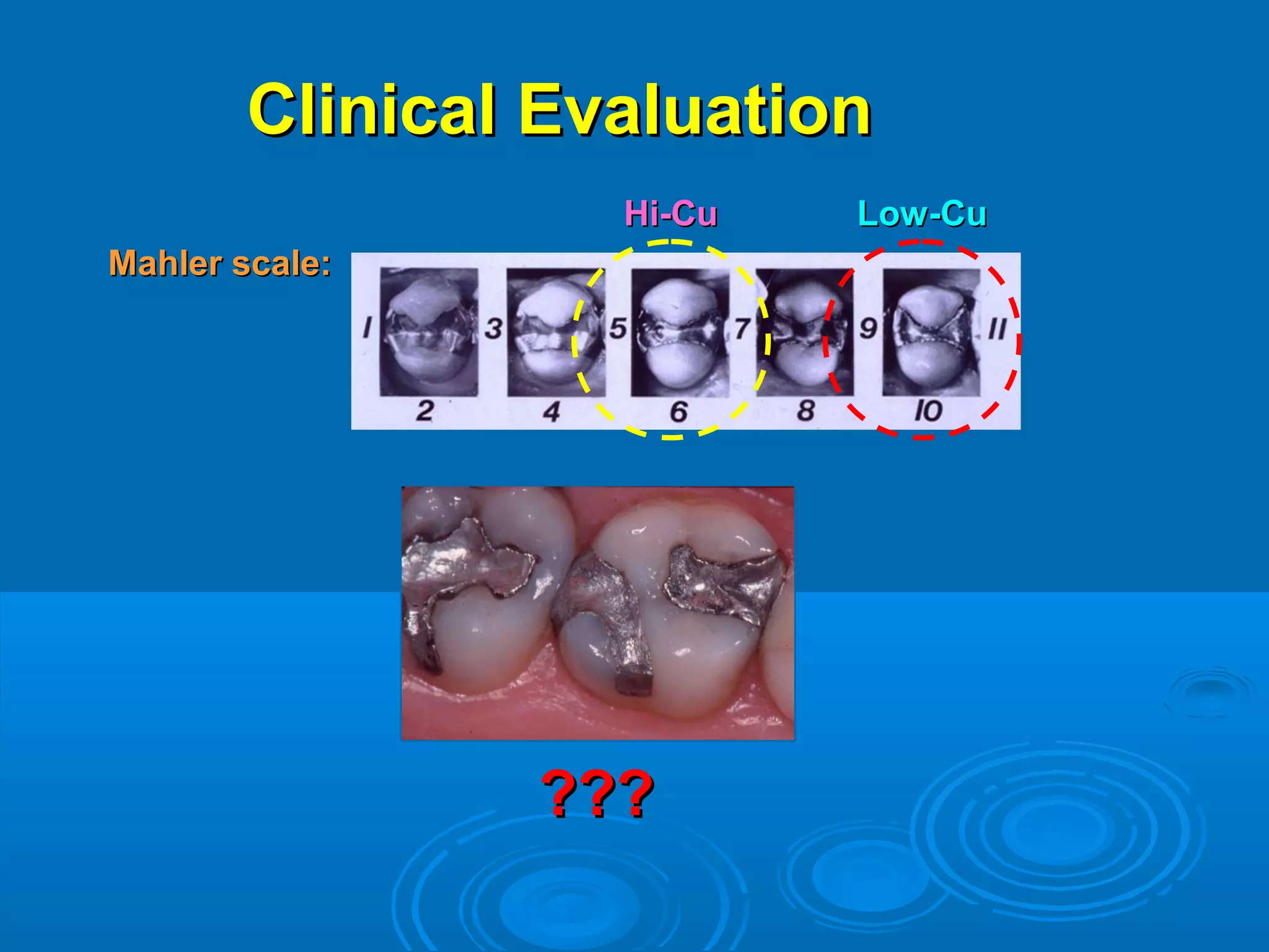 CClliinniiccaall EEvvaalluuaattiioonn 
MMaahhlleerr ssccaallee:: 
HHii--CCuu LLooww--CCuu 
?????? 
 