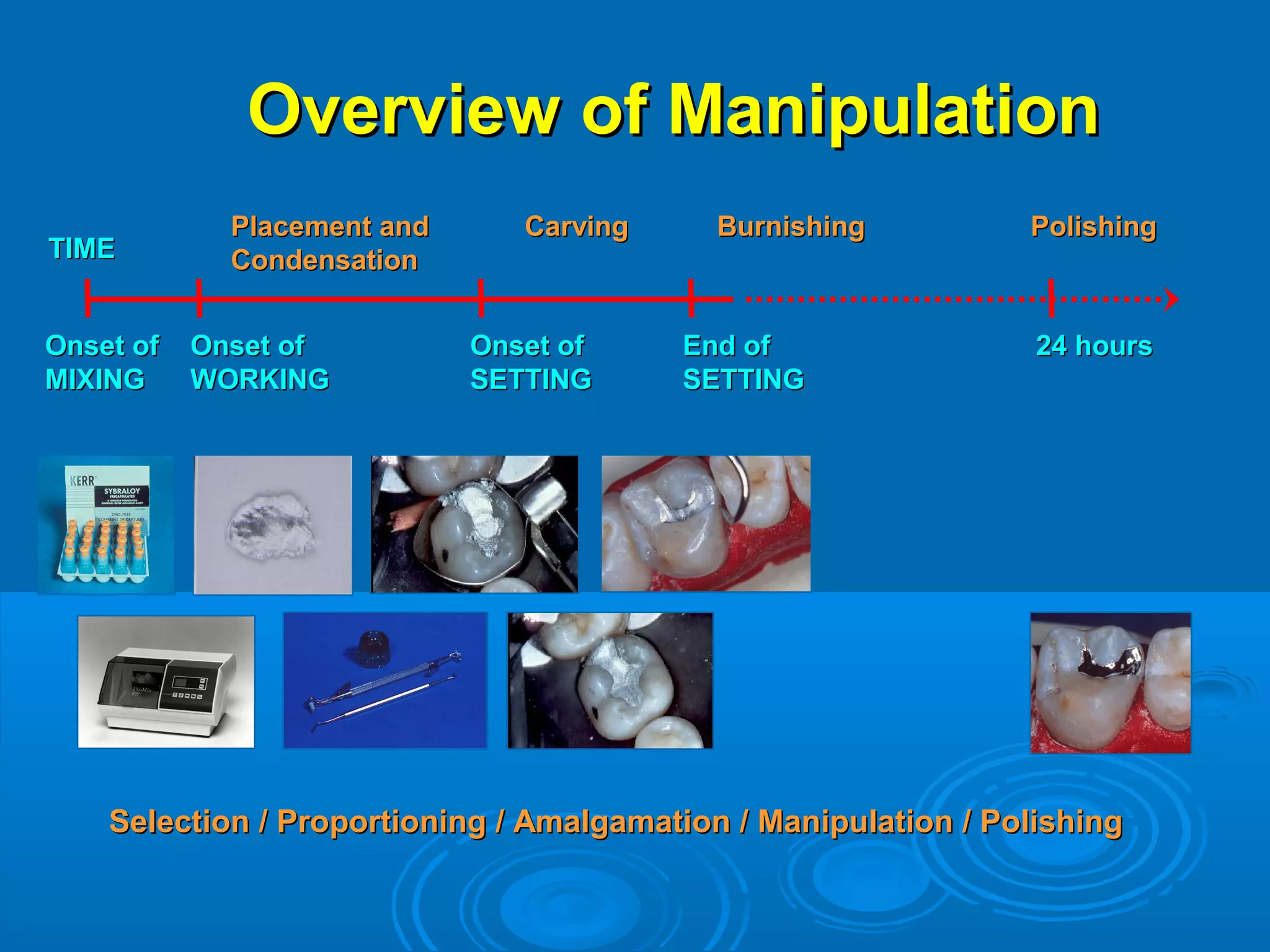 OOvveerrvviieeww ooff MMaanniippuullaattiioonn 
PPllaacceemmeenntt aanndd 
CCoonnddeennssaattiioonn 
CCaarrvviinngg BBuurrnniisshhiinngg PPoolliisshhiinngg 
TTIIMMEE 
OOnnsseett ooff 
MMIIXXIINNGG 
OOnnsseett ooff 
WWOORRKKIINNGG 
OOnnsseett ooff 
SSEETTTTIINNGG 
EEnndd ooff 
SSEETTTTIINNGG 
2244 hhoouurrss 
SSeelleeccttiioonn // PPrrooppoorrttiioonniinngg // AAmmaallggaammaattiioonn // MMaanniippuullaattiioonn // PPoolliisshhiinngg 
 