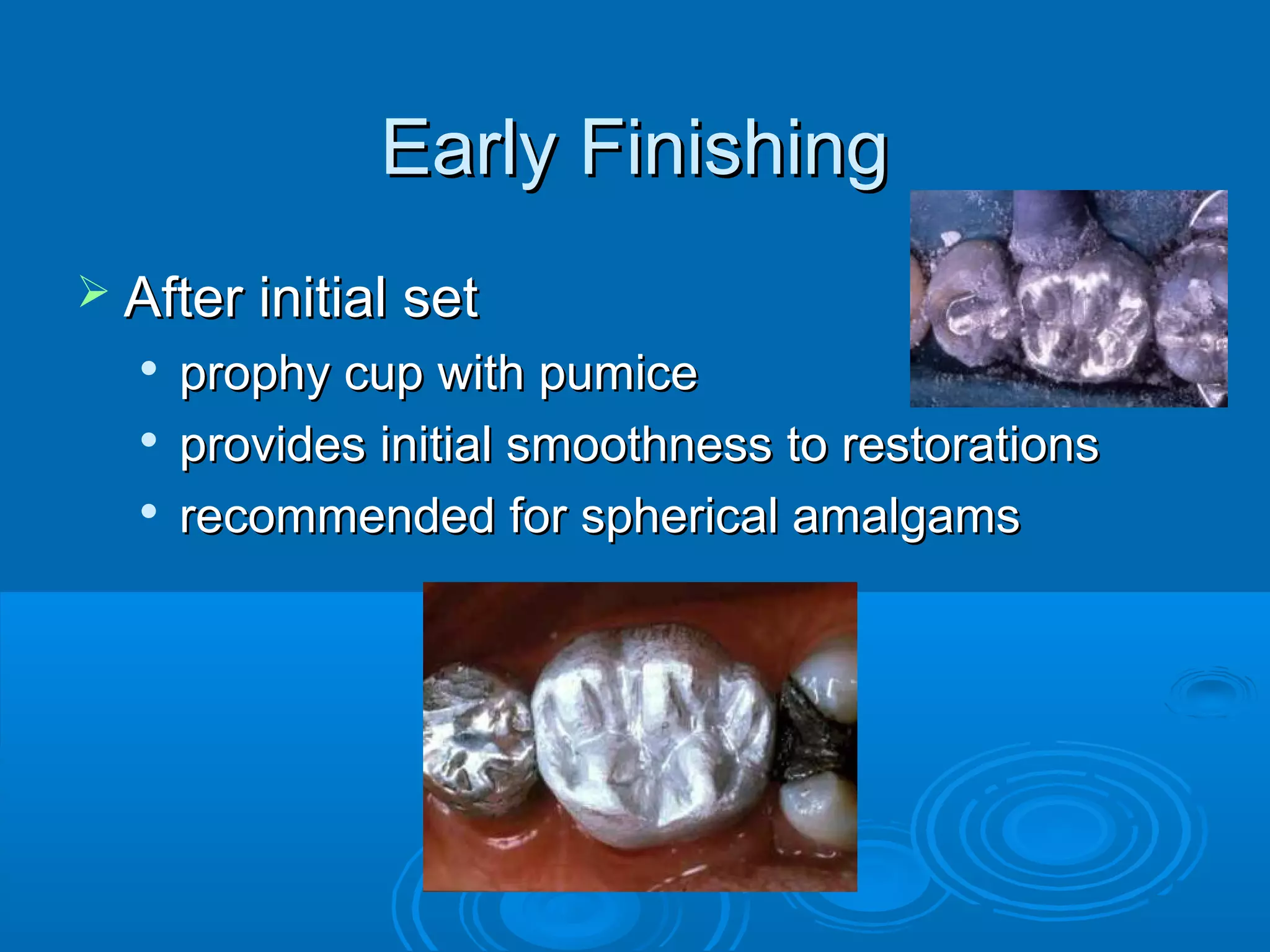 EEaarrllyy FFiinniisshhiinngg 
 AAfftteerr iinniittiiaall sseett 
 pprroopphhyy ccuupp wwiitthh ppuummiiccee 
 pprroovviiddeess iinniittiiaall ssmmooootthhnneessss ttoo rreessttoorraattiioonnss 
 rreeccoommmmeennddeedd ffoorr sspphheerriiccaall aammaallggaammss 
 