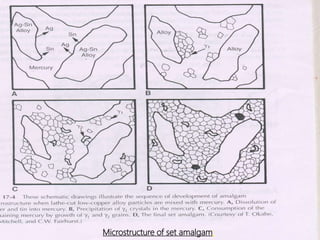 Microstructure of set amalgam:
 