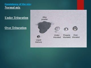 Consistency of the mix:
Normal mix
Under Trituration
Over Trituration
 