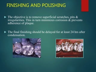 FINISHING AND POLISHING
 The objective is to remove superficial scratches, pits &
irregularities. This in turn minimizes corrosion & prevents
adherence of plaque.
 The final finishing should be delayed for at least 24 hrs after
condensation.
 