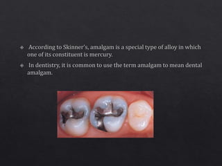 Amalgam | PPTX