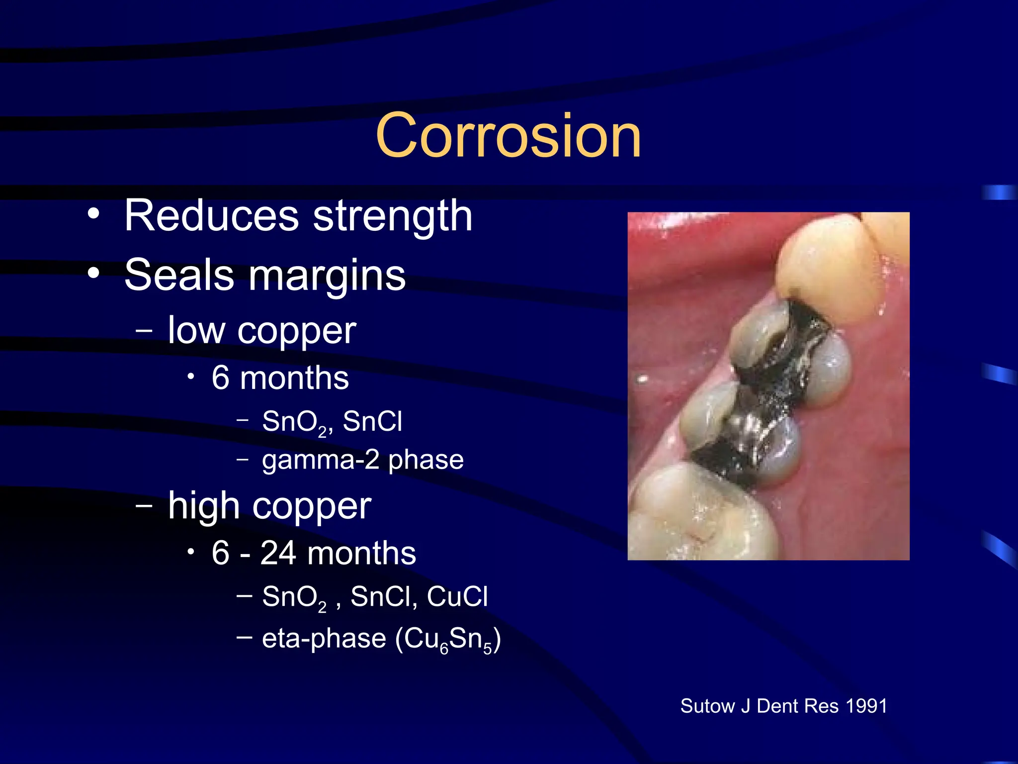 Corrosion
• Reduces strength
• Seals margins
– low copper
• 6 months
– SnO2, SnCl
– gamma-2 phase
– high copper
• 6 - 24 months
– SnO2 , SnCl, CuCl
– eta-phase (Cu6Sn5)
Sutow J Dent Res 1991
 