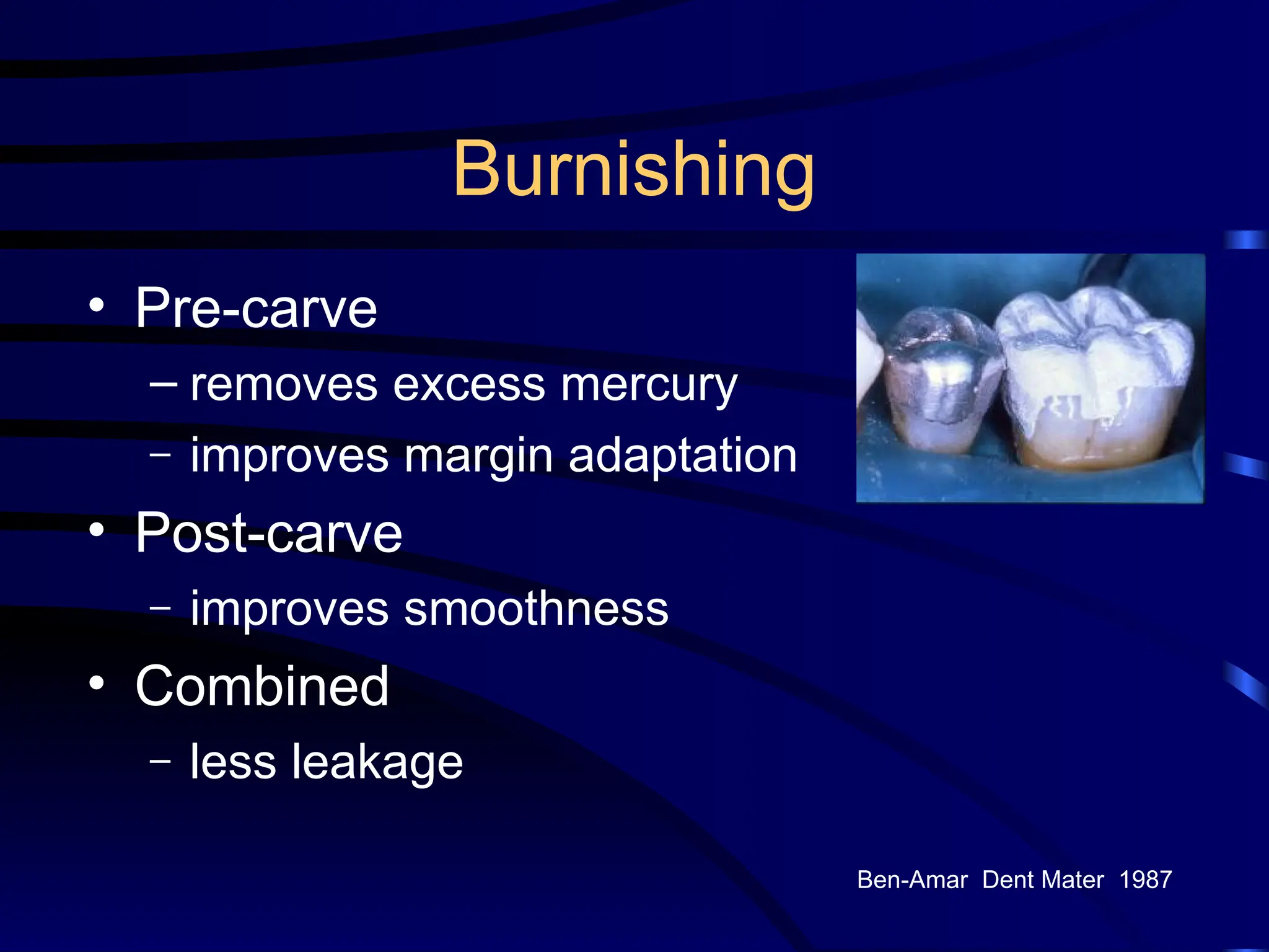 Burnishing
• Pre-carve
– removes excess mercury
– improves margin adaptation
• Post-carve
– improves smoothness
• Combined
– less leakage
Ben-Amar Dent Mater 1987
 