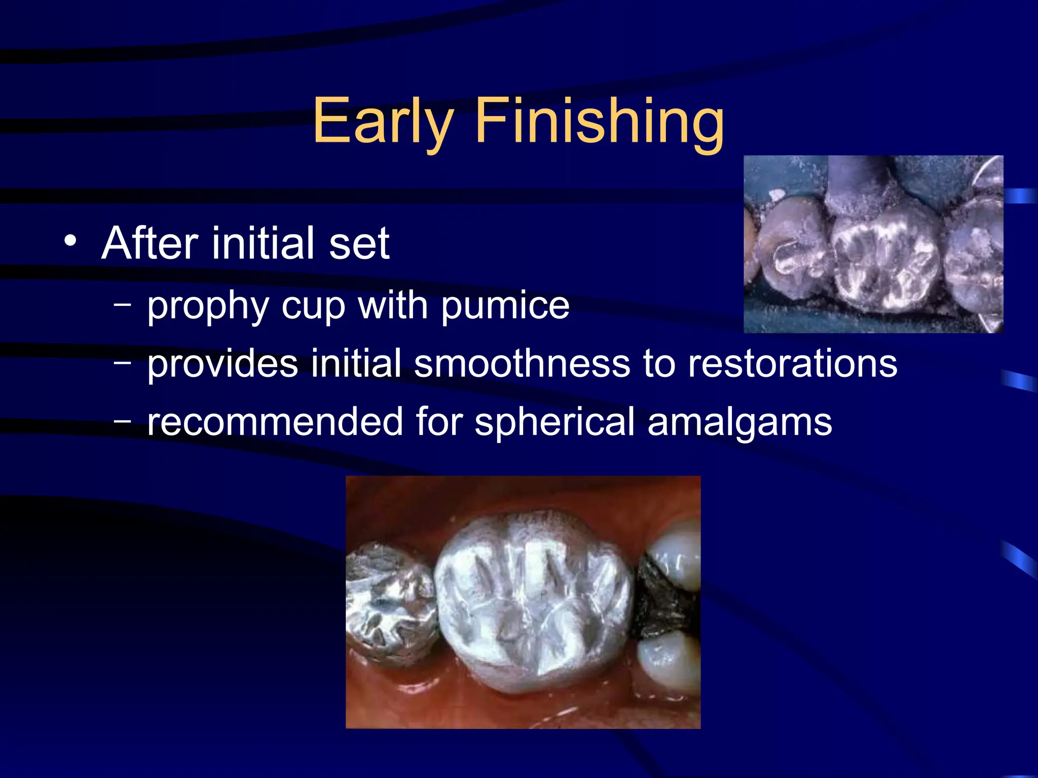 Early Finishing
• After initial set
– prophy cup with pumice
– provides initial smoothness to restorations
– recommended for spherical amalgams
 