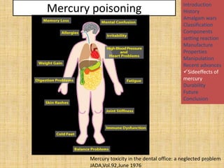 Mercury poisoning

Introduction
History
Amalgam wars
Classification
Components
setting reaction
Manufacture
Properties
Manipulation
Recent advances
Sideeffects of
mercury
Durability
Future
Conclusion

Mercury toxicity in the dental office: a neglected problem
105
JADA,Vol.92,June 1976

 