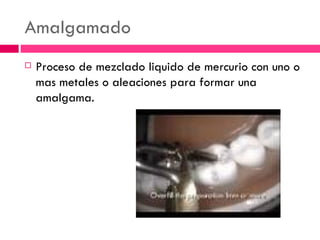 Amalgamado  Proceso de mezclado liquido de mercurio con uno o mas metales o aleaciones para formar una amalgama. 