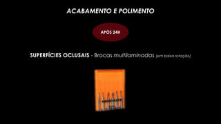 SUPERFÍCIES OCLUSAIS - Brocas multilaminadas (em baixa rotação)
ACABAMENTO E POLIMENTO
APÓS 24H
 