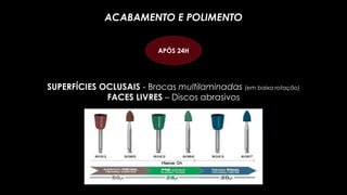 SUPERFÍCIES OCLUSAIS - Brocas multilaminadas (em baixa rotação)
FACES LIVRES – Discos abrasivos
ACABAMENTO E POLIMENTO
APÓS 24H
 