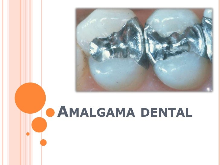 Amalgama dental