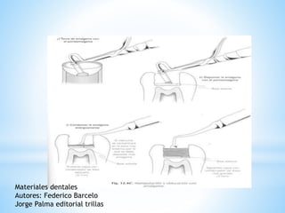 Materiales dentales
Autores: Federico Barcelo
Jorge Palma editorial trillas
 