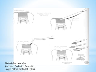 Materiales dentales
Autores: Federico Barcelo
Jorge Palma editorial trillas
 
