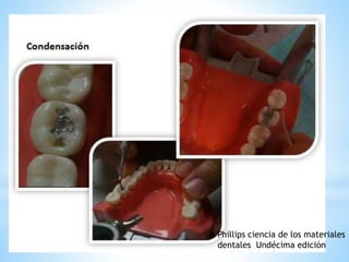 Phillips ciencia de los materiales
dentales Undécima edición
 