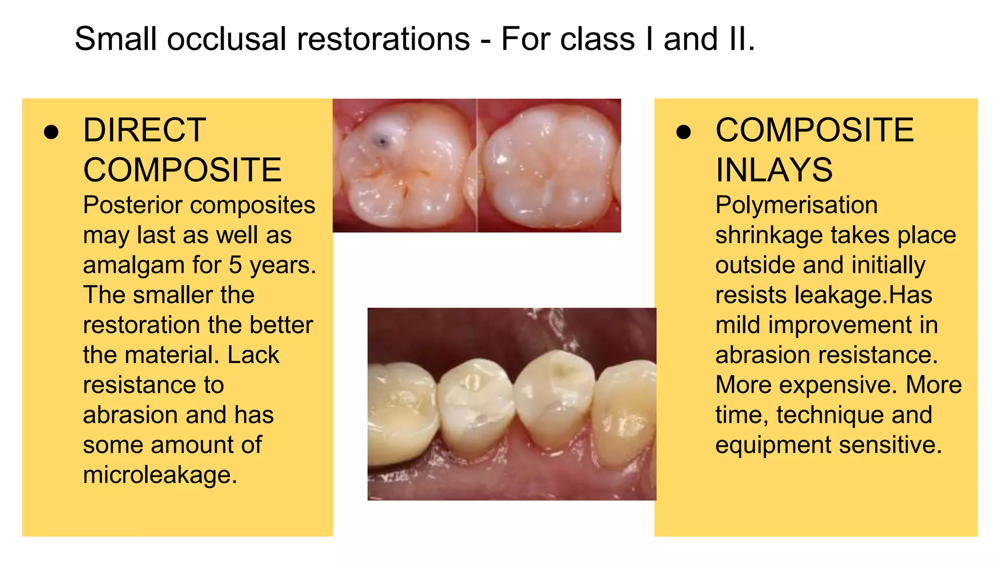 Amalgam alternatives PPT