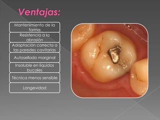 Mantenimiento de la
          forma
     Resistencia a la
        abrasión
Adaptación correcta a
 las paredes cavitarias
 Autosellado marginal
 Insoluble en líquidos
       bucales
Técnica menos sensible

     Longevidad
 