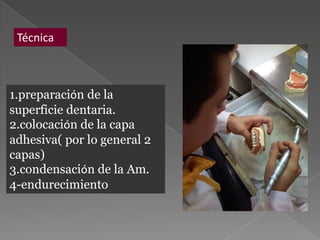 Técnica



1.preparación de la
superficie dentaria.
2.colocación de la capa
adhesiva( por lo general 2
capas)
3.condensación de la Am.
4-endurecimiento
 