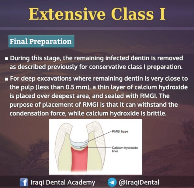 Amalgam Class I Restoration Explained