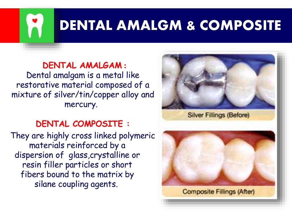 Amalgam