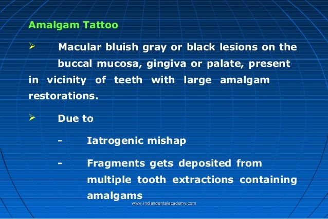 amalgam modified cosmetic dentistry courses amalgam modified cosmetic dentistry courses
