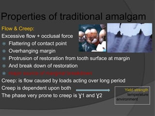 Properties of traditional amalgam
Flow & Creep:
Excessive flow + occlusal force
 Flattering of contact point
 Overhanging margin
 Protrusion of restoration from tooth surface at margin
 And break down of restoration
 major source of marginal breakdown
Creep: is flow caused by loads acting over long period
Creep is dependent upon both
The phase very prone to creep is Ɣ1 and Ɣ2
Yield strength
temperature
environment
 
