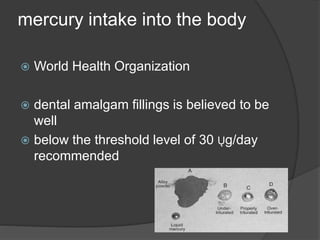 mercury intake into the body
 World Health Organization
 dental amalgam fillings is believed to be
well
 below the threshold level of 30 Ųg/day
recommended
 