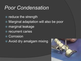 Poor Condensation
 reduce the strength
 Marginal adaptation will also be poor
 marginal leakage
 recurrent caries
 Corrosion
 Avoid dry amalgam mixing
 