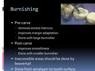 Burnishing
 Pre-carve
 removes excess mercury
 improves margin adaptation
 Done with large burnisher
 Post-carve
 improves smoothness
 Done with smaller burnisher
 Inaccessible areas should be done by
beavertail
 Done from amalgam to tooth surface.
 