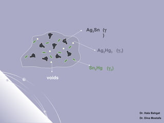 Ag3Sn (γ
)
Ag2Hg3 (γ 1)

Sn8Hg (γ 2)
voids

Dr. Hala Bahgat
Dr. Dina Mostafa

 