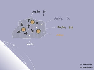 Ag3Sn

(γ
)
Ag2Hg3
Cu6Sn5

(γ 1)
(η)

AgCu
voids

Dr. Hala Bahgat
Dr. Dina Mostafa

 