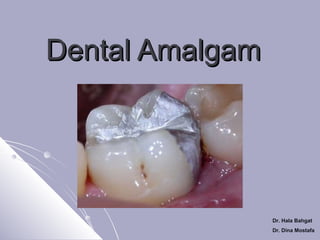 Dental Amalgam

Dr. Hala Bahgat
Dr. Dina Mostafa

 