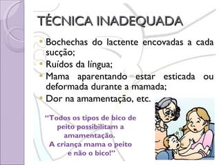 TÉCNICA INADEQUADA Bochechas do lactente encovadas a cada sucção; Ruídos da língua; Mama aparentando estar esticada ou deformada durante a mamada; Dor na amamentação, etc. “ Todos os tipos de bico de  peito possibilitam a  amamentação.  A criança mama o peito  e não o bico!” 
