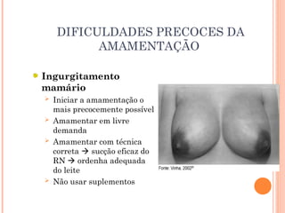DIFICULDADES PRECOCES DA
AMAMENTAÇÃO
Ingurgitamento
mamário
 Iniciar a amamentação o
mais precocemente possível
 Amamentar em livre
demanda
 Amamentar com técnica
correta  sucção eficaz do
RN  ordenha adequada
do leite
 Não usar suplementos
 
