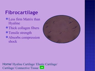 Fibrocartilage  Less firm Matrix than Hyaline Thick collagen fibers Tensile strength Absorbs compression shock Home /  Hyaline Cartilage /  Elastic Cartilage /  Cartilage /  Connective Tissue 