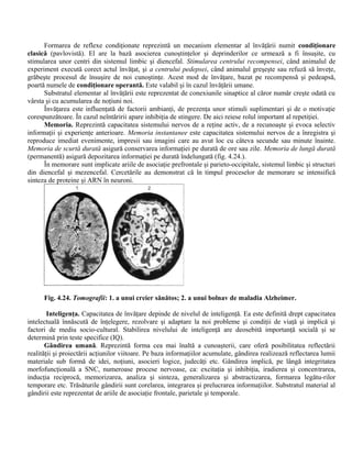 Formarea de reflexe condiţionate reprezintă un mecanism elementar al învăţării numit condiţionare
clasică (pavlovistă). El are la bază asocierea cunoştinţelor şi deprinderilor ce urmează a fi însuşite, cu
stimularea unor centri din sistemul limbic şi diencefal. Stimularea centrului recompensei, când animalul de
experiment execută corect actul învăţat, şi a centrului pedepsei, când animalul greşeşte sau refuză să înveţe,
grăbeşte procesul de însuşire de noi cunoştinţe. Acest mod de învăţare, bazat pe recompensă şi pedeapsă,
poartă numele de condiţionare operantă. Este valabil şi în cazul învăţării umane.
Substratul elementar al învăţării este reprezentat de conexiunile sinaptice al căror număr creşte odată cu
vârsta şi cu acumularea de noţiuni noi.
Învăţarea este influenţată de factorii ambianţi, de prezenţa unor stimuli suplimentari şi de o motivaţie
corespunzătoare. În cazul neîntăririi apare inhibiţia de stingere. De aici reiese rolul important al repetiţiei.
Memoria. Reprezintă capacitatea sistemului nervos de a reţine activ, de a recunoaşte şi evoca selectiv
informaţii şi experienţe anterioare. Memoria instantanee este capacitatea sistemului nervos de a înregistra şi
reproduce imediat evenimente, impresii sau imagini care au avut loc cu câteva secunde sau minute înainte.
Memoria de scurtă durată asigură conservarea informaţiei pe durată de ore sau zile. Memoria de lungă durată
(permanentă) asigură depozitarea informaţiei pe durată îndelungată (fig. 4.24.).
În memorare sunt implicate ariile de asociaţie prefrontale şi parieto-occipitale, sistemul limbic şi structuri
din diencefal şi mezencefal. Cercetările au demonstrat că în timpul proceselor de memorare se intensifică
sinteza de proteine şi ARN în neuroni.
Fig. 4.24. Tomografii: 1. a unui creier sănătos; 2. a unui bolnav de maladia Alzheimer.
Inteligenţa. Capacitatea de învăţare depinde de nivelul de inteligenţă. Ea este definită drept capacitatea
intelectuală înnăscută de înţelegere, rezolvare şi adaptare la noi probleme şi condiţii de viaţă şi implică şi
factori de mediu socio-cultural. Stabilirea nivelului de inteligenţă are deosebită importanţă socială şi se
determină prin teste specifice (IQ).
Gândirea umană. Reprezintă forma cea mai înaltă a cunoaşterii, care oferă posibilitatea reflectării
realităţii şi proiectării acţiunilor viitoare. Pe baza informaţiilor acumulate, gândirea realizează reflectarea lumii
materiale sub formă de idei, noţiuni, asocieri logice, judecăţi etc. Gândirea implică, pe lângă integritatea
morfofuncţională a SNC, numeroase procese nervoase, ca: excitaţia şi inhibiţia, iradierea şi concentrarea,
inducţia reciprocă, memorizarea, analiza şi sinteza, generalizarea şi abstractizarea, formarea legătu-rilor
temporare etc. Trăsăturile gândirii sunt corelarea, integrarea şi prelucrarea informaţiilor. Substratul material al
gândirii este reprezentat de ariile de asociaţie frontale, parietale şi temporale.
 