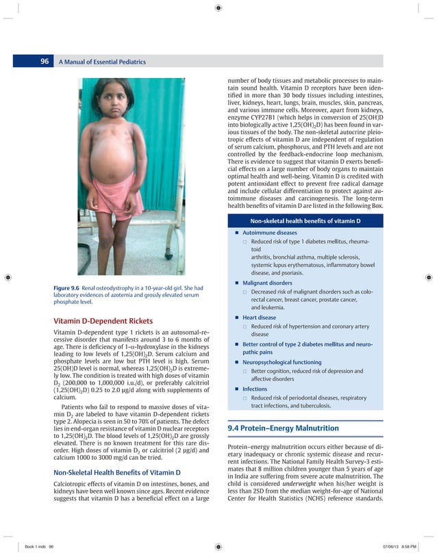 A Manual of Essential PediatricsMeharban Singh PDF