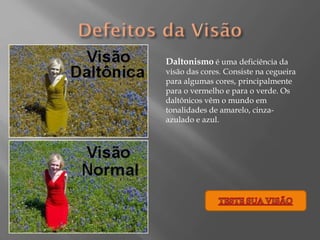 Daltonismo é uma deficiência da
visão das cores. Consiste na cegueira
para algumas cores, principalmente
para o vermelho e para o verde. Os
daltônicos vêm o mundo em
tonalidades de amarelo, cinzaazulado e azul.

 