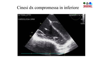 Cinesi dx compromessa in inferiore
 
