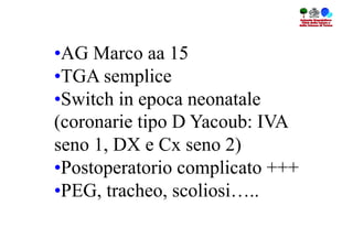 • AG Marco aa 15
• TGA semplice
• Switch in epoca neonatale
(coronarie tipo D Yacoub: IVA
seno 1, DX e Cx seno 2)
• Postoperatorio complicato +++
• PEG, tracheo, scoliosi…..
 