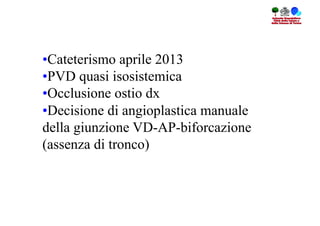 • Cateterismo aprile 2013
• PVD quasi isosistemica
• Occlusione ostio dx
• Decisione di angioplastica manuale
della giunzione VD-AP-biforcazione
(assenza di tronco)
 