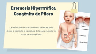 estenosis pilorica | PPTX