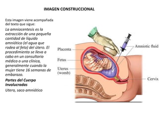IMAGEN CONSTRUCCIONAL
Esta imagen viene acompañada
del texto que sigue:
La amniocentesis es la
extracción de una pequeña
cantidad de líquido
amniótico (el agua que
rodea al feto) del útero. El
procedimiento se lleva a
cabo en un consultorio
médico o una clínica,
generalmente cuando la
mujer tiene 16 semanas de
embarazo.
Partes del Cuerpo
Involucradas
Utero, saco amniótico
 