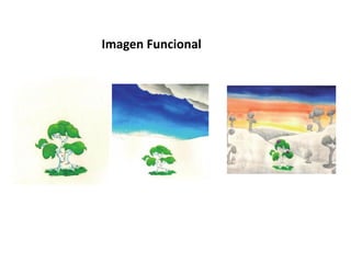 Imagen Funcional
 