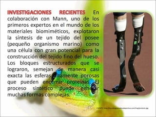 FUENTE: http://tecnologiamedicadeportiva.com/img/protesis.jpg 