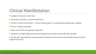 Amaurosis Fugax | PPT