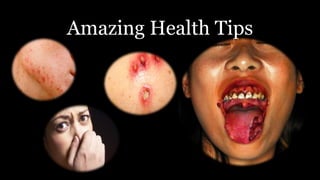 Amazing Health Tips
 