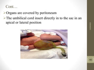 Neonatal nursing care for GZIT[Autosaved].ppt